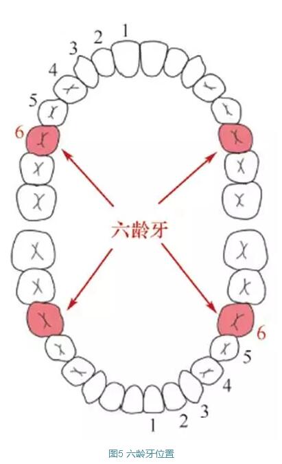 在咀嚼过程中起重要作用,同时也是影响牙齿排列的重要因素,因此保证六